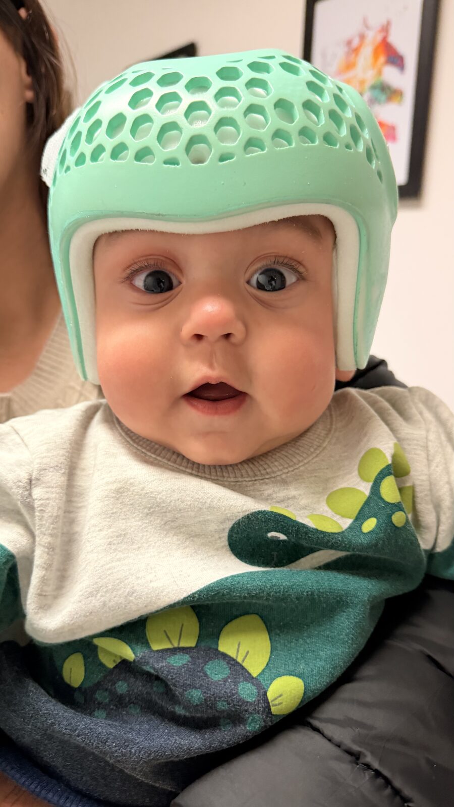 Modelos de órteses cranianas no Espaço Longévité
